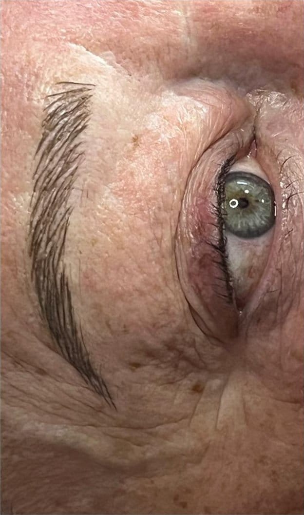 A sparse brow before microblading, and a full, defined brow after